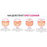 Вакуумний очищувач пор обличчя Spot Cleaner, фото 5