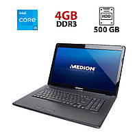 Ноутбук Medion Akoya E7214/ 17.3" (1600x900)/ Core i5-430M/ 4 GB RAM/ 500 GB HDD/ HD/ АКБ 0%