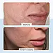 Відновлюючий крем для обличчя та тіла First Aid Beauty Ultra Repair Cream 56.7 г, фото 6