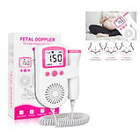 Електронний стетоскоп для вагітних доплер діагностика, фото 7