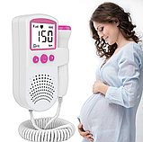 Електронний стетоскоп для вагітних доплер діагностика, фото 3