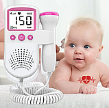 Електронний стетоскоп для вагітних доплер діагностика, фото 6