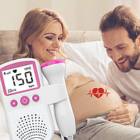 Доплер для вагітних JSL-T501 доплера УЗД моніторинг стану плода