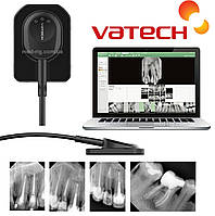 Визиографы Vatech Classic 1.5 Радиовизиограф Визиограф Стоматологический Визиографы Дентальные Южная Корея VC