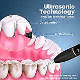 Ультразвуковий очисник зубів Бездротова камера Стоматологічний наліт, фото 3