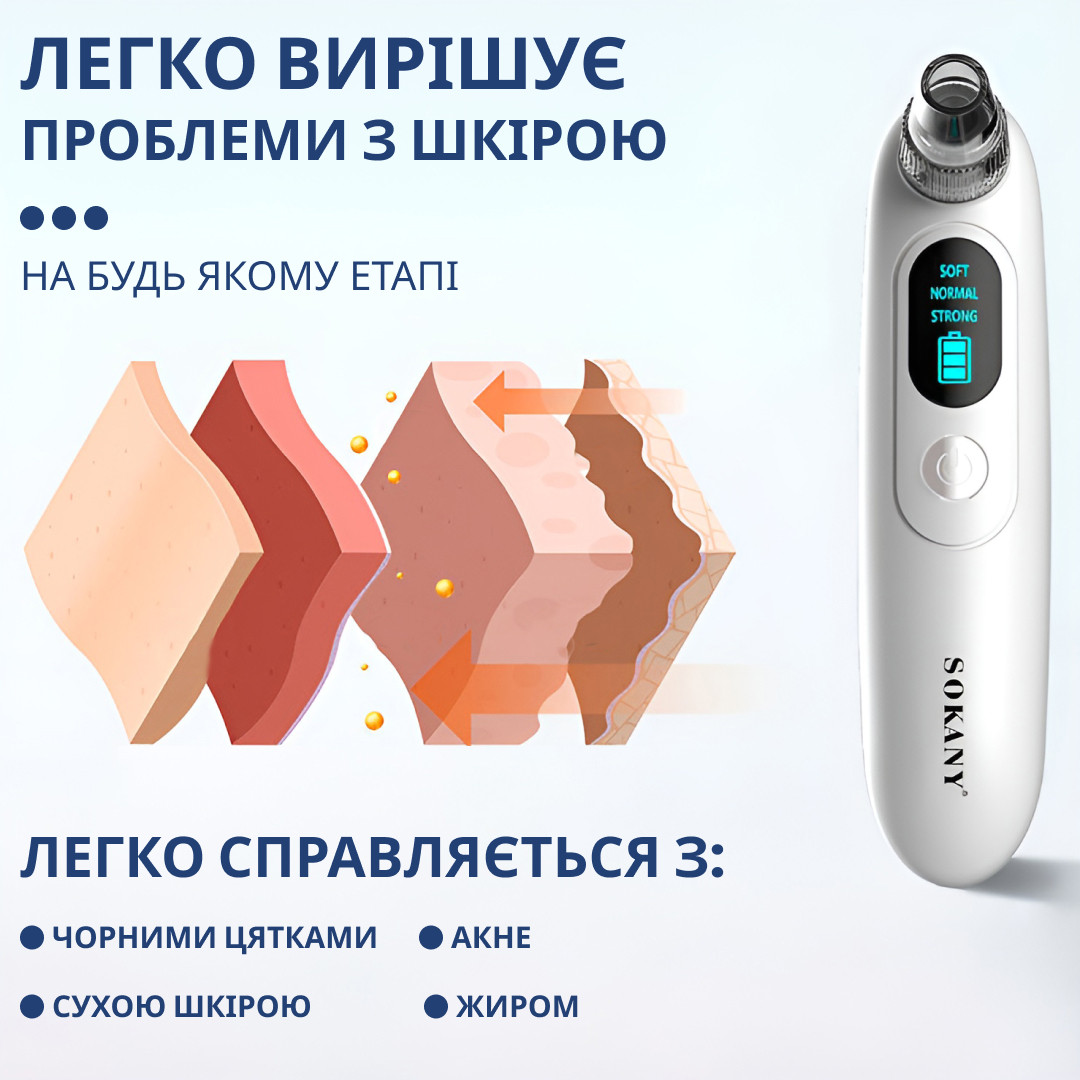 LUGI Очиститель вакуумный для пор кожи лица 3 в 1 аппарат для чистки черных точек Sokany SK-319 - фото 6 - id-p2112665902
