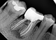 Дентальний рентген Woodpecker портативний рентген апарат Mini Ray рентген апарат дентальний, фото 6