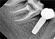 Дентальний рентген Woodpecker портативний рентген апарат Mini Ray рентген апарат дентальний, фото 8