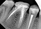 Дентальний рентген Woodpecker Mini Ray портативний рентген апарат рентген апарат дентальний WMR, фото 9