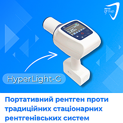 Портативний рентген HyperLight-G проти традиційних стаціонарних рентгенівських систем
