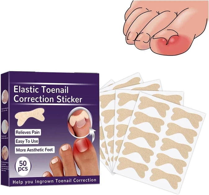Набір пластирів Elastic Toenail Correction Sticker для корекції та усунення врослих нігтів (50 шт.)  YU227