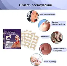 Набір пластирів Elastic Toenail Correction Sticker для корекції та усунення врослих нігтів (50 шт.)  YU227, фото 2