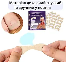 Набір пластирів Elastic Toenail Correction Sticker для корекції та усунення врослих нігтів (50 шт.)  YU227, фото 2