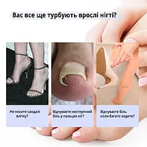 Набір пластирів Elastic Toenail Correction Sticker для корекції та усунення врослих нігтів (50 шт.)  YU227, фото 3