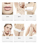 Фотоепілятор Doc-team HR IPL домашній епілятор. Лазерний епілятор 990 тис спалахів, фото 9