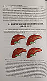 ХОЛІНГІОЦЕЛЛЮЛЯРНА КАРЦИНОМА Під редакцією професора А.В. Чжао, фото 7
