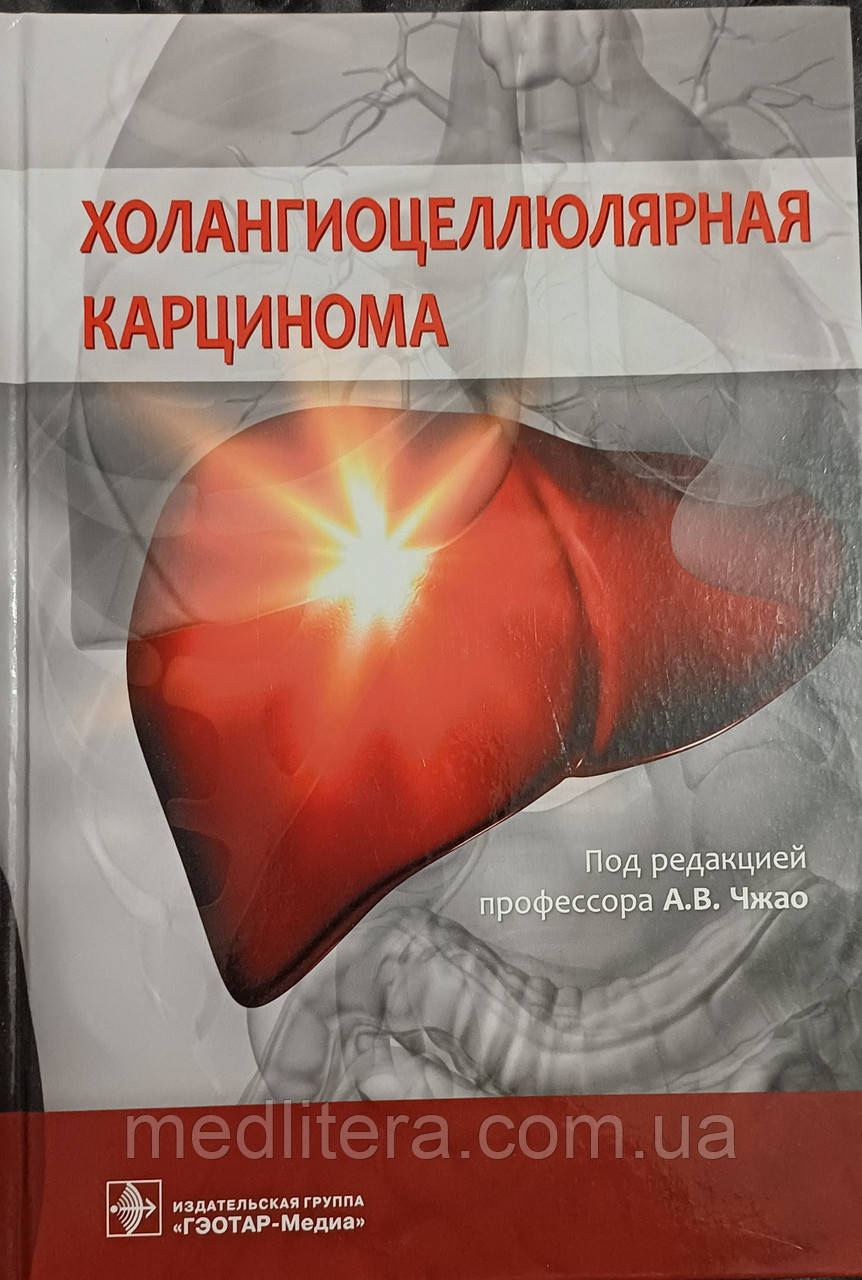 ХОЛІНГІОЦЕЛЛЮЛЯРНА КАРЦИНОМА
Під редакцією професора А.В. Чожао
