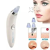 Вакуумный очиститель пор от черных точек Derma Suction, аппарат для чистки лица