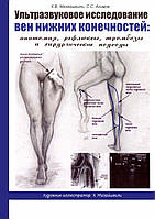 УЗИ вен нижних конечностей: анатомия, рефлюксы, тромбоз и хирургические подходы. 2022. Мазайшвили К.В.,Акимов