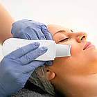 Ультразвуковий скрабер для чищення обличчя, від USB, MGE-008 / Бездротовий апарат для чищення пор обличчя, фото 6