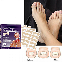 Набор пластырей Elastic Toenail Correction Sticker (50 pcs) (1000)