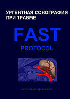 Ургентная сонография при травме. FAST protocol.