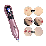 Коагулятор для видалення бородавок портативний засіб для видалення бородавок лазерні коагулятори, фото 5