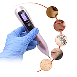 Коагулятор для видалення бородавок портативний засіб для видалення бородавок лазерні коагулятори, фото 9