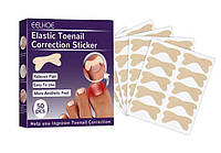 Набор из 50пластерей пластырей Elastic Toenail Correction Sticker
