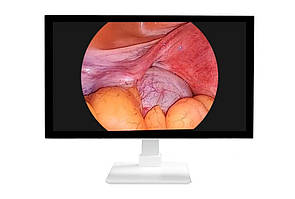 Монітори ендоскопічні