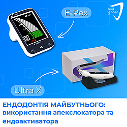 Ендодонтія майбутнього: використання апекслокатора E-Pex, ендоактиватора Ultra X