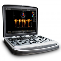Портативный ультразвуковой аппарат экспертного класса SonoBook 6 + 2 датчики (CHISON)
