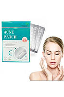 Патчи Acne Patch от акне и воспалений 72 шт./1 уп 171560T Бесплатная доставка