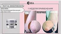 Rhea Cosmetics SOS Skin - Відновлюючий бальзам для шкіри обличчя та тіла