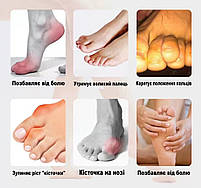 Фіксатор для пальця ноги. Подвійний гельовий фіксатор. Коректори для кісточки великого пальця, фото 9