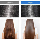 Шампунь для глибокого очищення шкіри голови з 5 видами пробіотиків Masil 5 Probiotics Scalp Scaling Shampoo (150 ml), фото 4