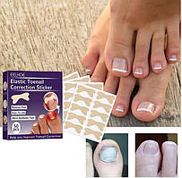 Набір пластирів Elastic Nail Corrector Patches (50 шт.) Premium