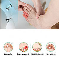 Силіконовий чохол (напальчник) для пальців ніг білі 1 пара (2шт). Гелеві напальчники для ніг від мозолів, фото 7