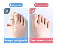 Коректор пальців стопи. Силіконовий міжпальцевий коректор розділювач пальців колір бежевий 1 пара, фото 4