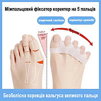 Коректор пальців стопи. Силіконовий міжпальцевий коректор розділювач пальців колір бежевий 1 пара, фото 3