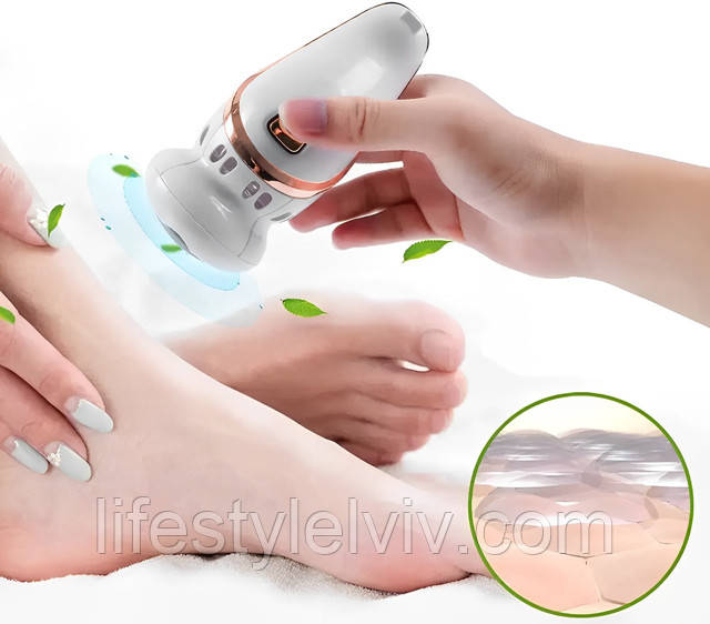 Електрична пемза Callus remover vacuum (WM-47) (60), ціна 271.82 грн - Prom.ua (ID#1441416970)