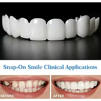 Вініри Snap-On Smile вставні зуби - максимально не помітні для оточуючих -  - 2 штуки - Верх тиз Низ