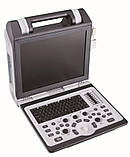 Портативна ультразвукова система SIUI Apogee 2100, фото 3