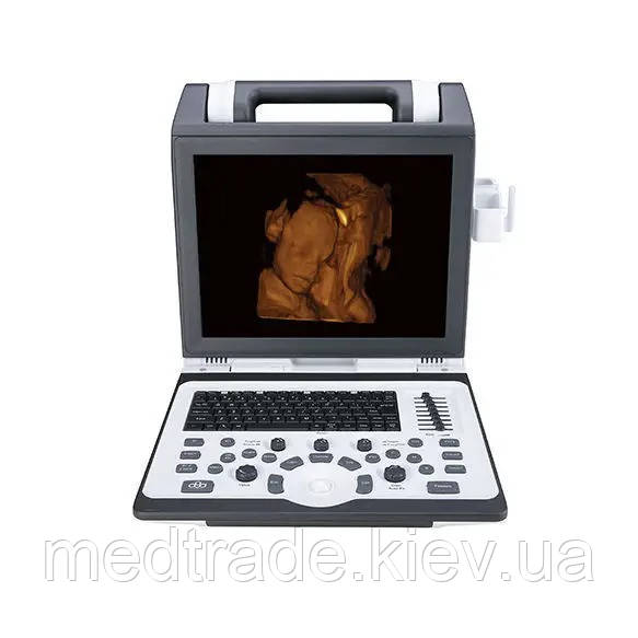 Портативна ультразвукова система SIUI Apogee 2100
