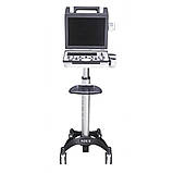 Портативна ультразвукова система SIUI Apogee 2100, фото 5