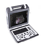 Портативна ультразвукова система SIUI Apogee 2100, фото 6