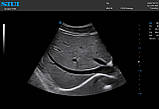 Ультразвукова система SIUI Apogee 6300, фото 4
