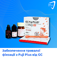 Забезпечення тривалої фіксації з Fuji Plus, GC