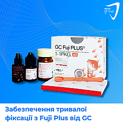 Забезпечення тривалої фіксації з Fuji Plus, GC