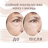 Кінезіотейп для чутливої шкіри обличчя Ares Beauty Gentle Half 2,5 см х 10 м (Южна Корея), фото 5